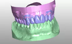 Complete dental model