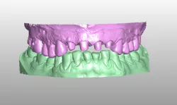 Previous dental models