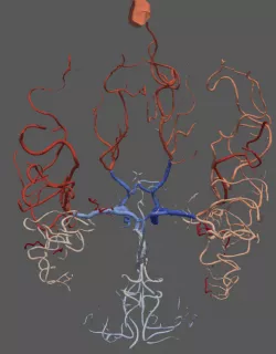 3d brain vasculature model