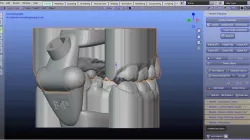 Models with articulator (without base)