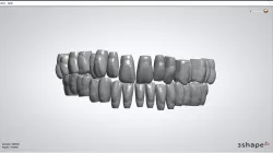 Square teeth