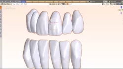 Sup-Inf tooth library