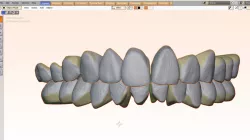 Tooth library