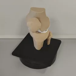 Human knee with support (Scale 1:1)