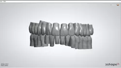ANG tooth library