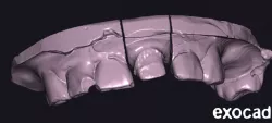 Piece 21 single crown cemnetada
