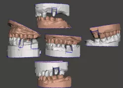 Sample Data for Dental Design Practice