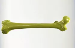 Femur Bone