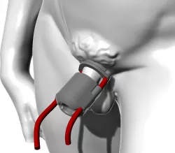 Modular bdsm