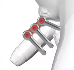 Schackel toy
