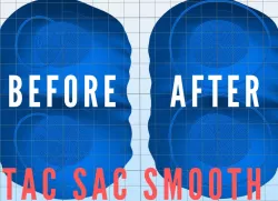 TAC SAC Foregrip Remix
