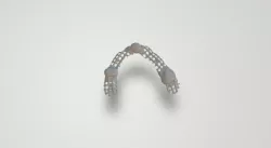 Dental partial framework metal