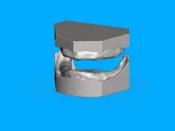 Edentulous Models - Meshmixer.
