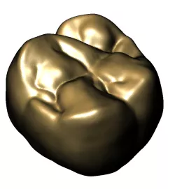 Maxillary Molar 1
