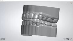 Models with programmed occlusal plate