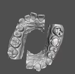 Training Teeth for Dental Students Black Dental Caries Classification
