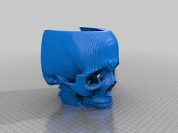 F Front Maxillo Facial Bones CT 3D Scan
