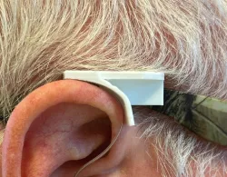 Hearing aid wind deflector 