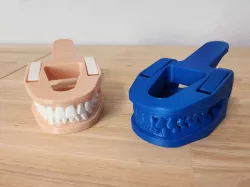 Mouth Chip Clip from 3D Scan of Teeth