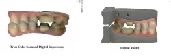 Digital Dental Models Building