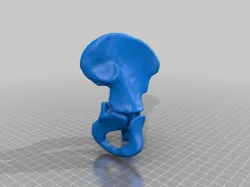 femur