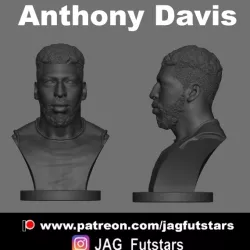 Anthony Davis - Lakers - Bust