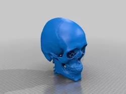 Anonymous CT Skull 3