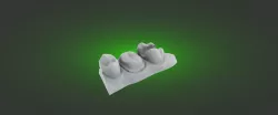 human jaw teeth