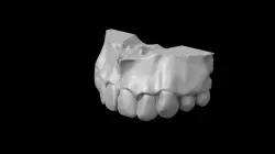 Upper jaw
