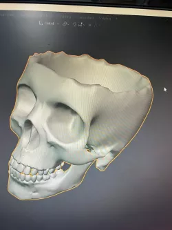 Broken Skull-Vase
