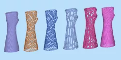 Splint