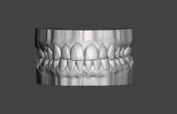 Dental model, mouth, teeth