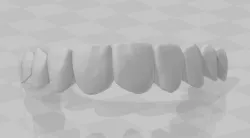 teeth