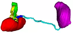 3D Model of Urinary System - generated from real patient