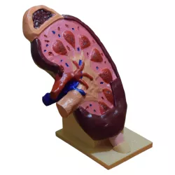 Kidney - Kidney