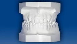 Base Para Modelo Dental