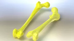 Femur Bone