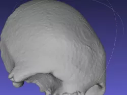 Frontal bone anatomical model