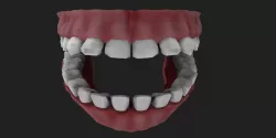 dentures