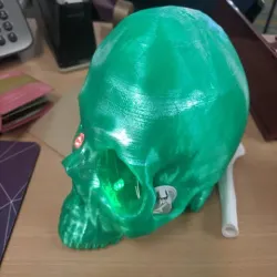 Skull CT Scan w/ Brain Cavity