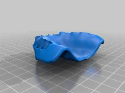 Denture