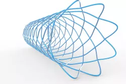 braided stent