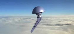 Design of an Endoprosthetic Hip Implant