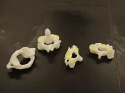 Human cervical vertebrae, C1-C4