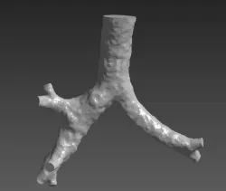 Human Trachea