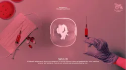 The aneurysm  pebble