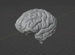 brain cortex