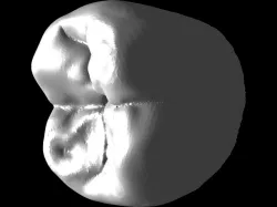 CORONA METALICA