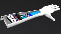 Forearm / Prosthesis