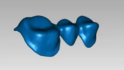 Teeth AAA